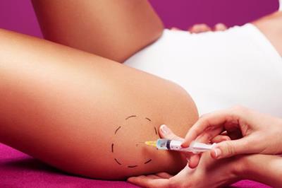 Mesoterapia