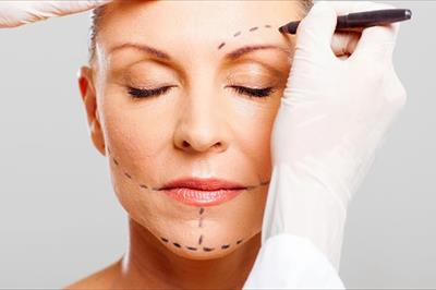 Lifting (minilifting) viso